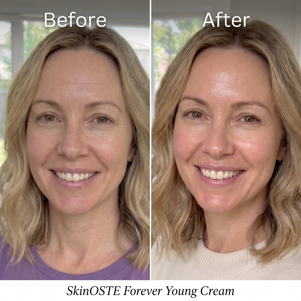 SkinOSTE Forever Young Cream